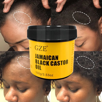 GZE Pure Jamaican Black Castor Oil – Hair & Skin Care