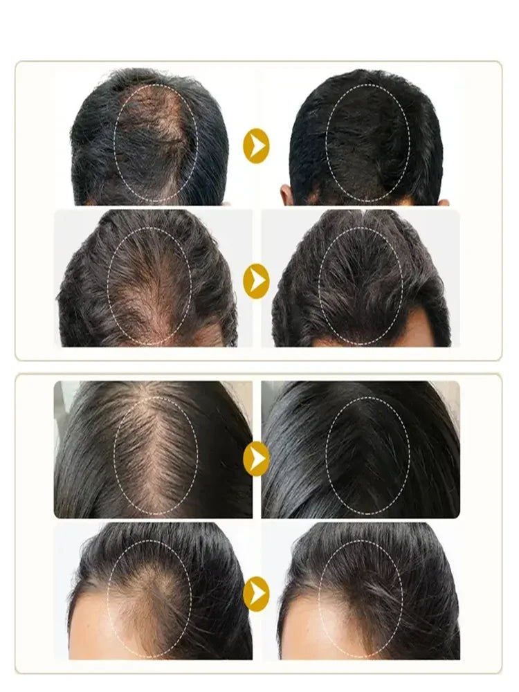 Black Castor Oil Hair Conditioner – Moisturizing Curl Definer & Repair Treatment for Dry Hair